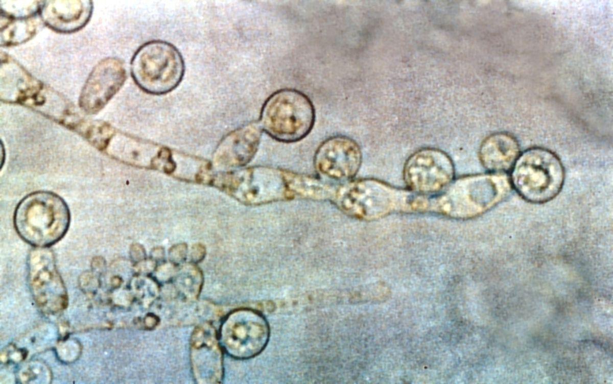 1200px candida albicans 2