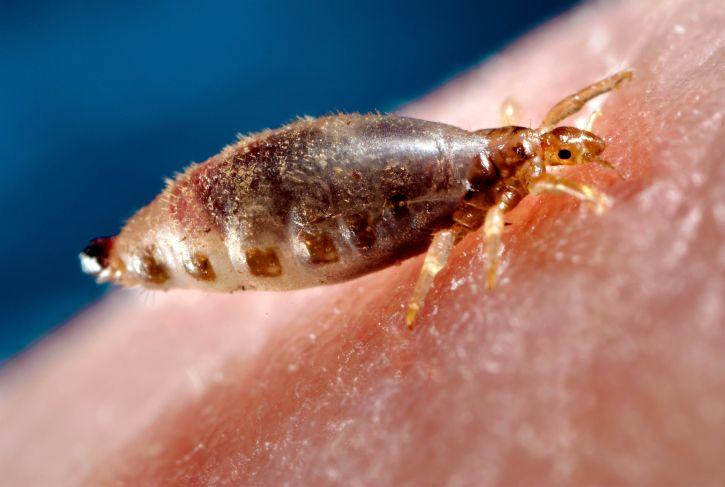 Body lice are parasitic insects that live on the body and in the clothing or bedding of infested humans 725x487